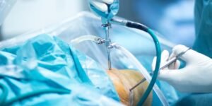 Read more about the article Arthroscopic Surgery: A Minimally Invasive Solution for Joint Problems